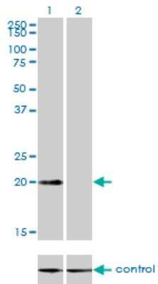 Western Blot: CSRP3 Antibody (6D2) [H00008048-M03] - Western blot analysis of CSRP3 over-expressed 293 cell line, cotransfected with CSRP3 Validated Chimera RNAi or non-transfected control. Blot probed with H00008048-M03. GAPDH (36.1 kDa) used as loading control.