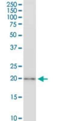 Western Blot: CSRP3 Antibody (6D2) [H00008048-M03] - Analysis of CSRP3 expression in Hela S3 NE.