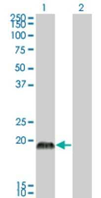 Western Blot: CSRP3 Antibody (6D2) [H00008048-M03] - Analysis of CSRP3 expression in transfected 293T cell line by CSRP3 monoclonal antibody (M03), clone 6D2. Lane 1: CSRP3 transfected lysatE (20.969 KDa). Lane 2: Non-transfected lysate.