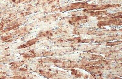 Immunohistochemistry-Paraffin: CSRP3 Antibody [NBP1-32974] - Mouse heart. CSRP3 stained by CSRP3 antibody diluted at 1:500. Antigen Retrieval: Citrate buffer, pH 6.0, 15 min.