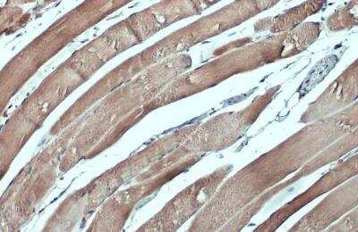 Immunohistochemistry-Paraffin: CSRP3 Antibody [NBP1-32974] - Mouse muscle. CSRP3 stained by CSRP3 antibody diluted at 1:500. Antigen Retrieval: Citrate buffer, pH 6.0, 15 min.