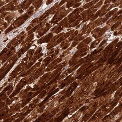 <b>Orthogonal Strategies Validation. </b>Immunohistochemistry-Paraffin: CSRP3 Antibody [NBP2-13880] - Staining of human heart muscle shows high expression.