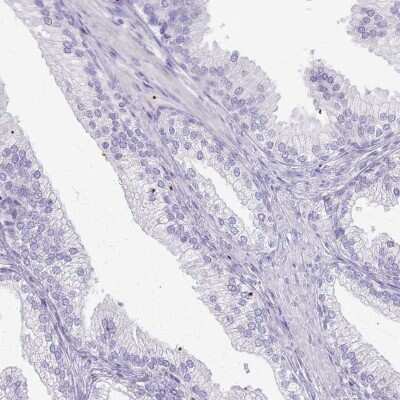 Immunohistochemistry-Paraffin: CSRP3 Antibody [NBP2-13880] - Staining of human prostate shows low expression as expected.