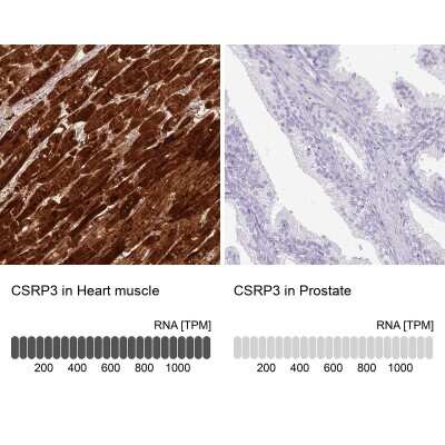 Immunohistochemistry-Paraffin: CSRP3 Antibody [NBP2-13880] - Staining in human heart muscle and prostate tissues using anti-CSRP3 antibody. Corresponding CSRP3 RNA-seq data are presented for the same tissues.