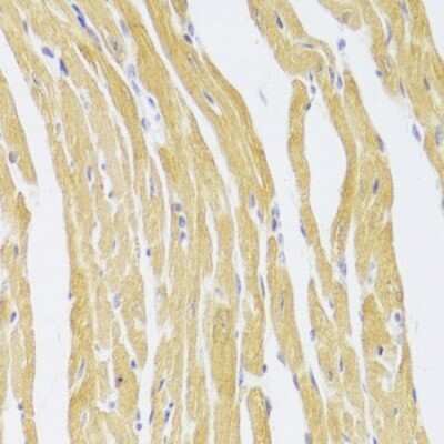 Immunohistochemistry-Paraffin: CSRP3 Antibody [NBP2-92797] - Mouse heart using CSRP3 Antibody at dilution of 1:100 (40x lens).