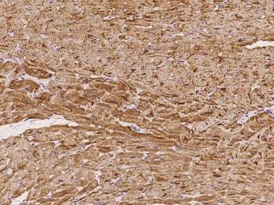 Immunohistochemistry-Paraffin: CSRP3 Antibody [NBP2-97433] - Immunochemical staining of human CSRP3 in cynomolgus heart with rabbit polyclonal antibody at 1:100 dilution, formalin-fixed paraffin embedded sections.