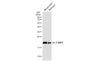 Western Blot: CSRP3 Antibody [NBP1-32974] - Various tissue extracts (50 ug) were separated by 12% SDS-PAGE, and the membrane was blotted with CSRP3 antibody diluted at 1:1000. HRP-conjugated anti-rabbit IgG antibody was used to detect the primary antibody.