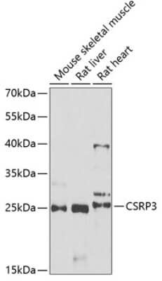 Western Blot: CSRP3 Antibody [NBP2-92797] - Analysis of extracts of various cell lines, using CSRP3 .Exposure time: 90s.