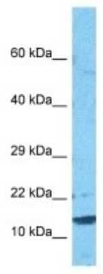 Western Blot CST9L Antibody