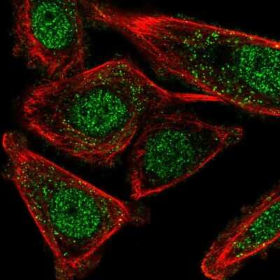 Immunocytochemistry/Immunofluorescence: CSTF2T Antibody [NBP2-49353] - Immunofluorescent staining of human cell line PC-3 shows localization to nucleoplasm & vesicles.