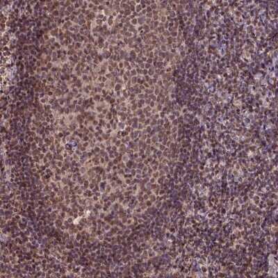 Immunohistochemistry-Paraffin: CSTF2T Antibody [NBP2-49353] - Staining of human tonsil shows moderate nuclear positivity in germinal center cells and non-germinal center cells.