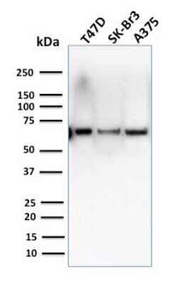 Western Blot: CSTF2T Antibody (PCRP-CSTF2T-1A3) [NBP3-07486] - Western Blot Analysis of human T47D, SK-Br3 & A375 cell lysates using CSTF2T Mouse Monoclonal Antibody (PCRP-CSTF2T-1A3).