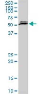 Western Blot: CSTF2T Antibody [H00023283-B01P] - Analysis of CSTF2T expression in rat brain.