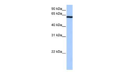 Western Blot: CSTF2T Antibody [NBP2-87221] - WB Suggested Anti-CSTF2T Antibody Titration: 0.2-1 ug/ml. Positive Control: Human brain