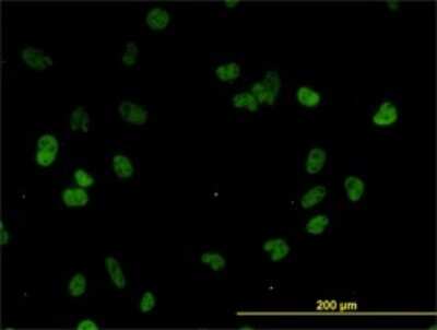 Immunocytochemistry/Immunofluorescence: CSTF3 Antibody (1D4) [H00001479-M01] - Analysis of monoclonal antibody to CSTF3 on HeLa cell. Antibody concentration 10 ug/ml.