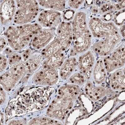 Immunohistochemistry-Paraffin: CSTF3 Antibody [NBP1-85427] - Staining of human kidney shows strong nuclear positivity in cells in renal tubules.