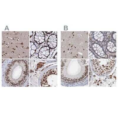 <b>Independent Antibodies Validation. </b>Immunohistochemistry-Paraffin: CSTF3 Antibody [NBP1-85427] - Staining of human cerebral cortex, colon, epididymis and testis using Anti-CSTF3 antibody NBP1-85427 (A) shows similar protein distribution across tissues to independent antibody NBP1-85428 (B).