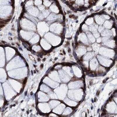 Immunohistochemistry-Paraffin: CSTF3 Antibody [NBP1-85427] - Staining of human colon.