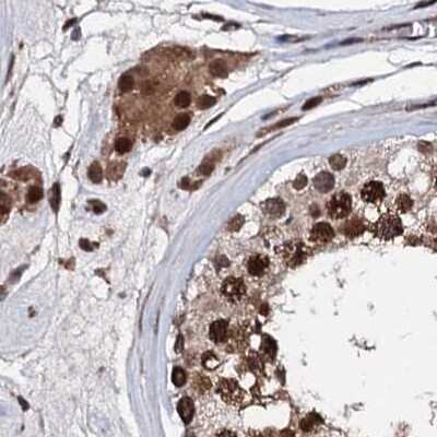 <b>Independent Antibodies Validation. </b>Immunohistochemistry-Paraffin: CSTF3 Antibody [NBP1-85427] - Staining of human testis.