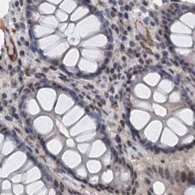 Immunohistochemistry-Paraffin: CSTF3 Antibody [NBP1-85428] - Staining of human colon.