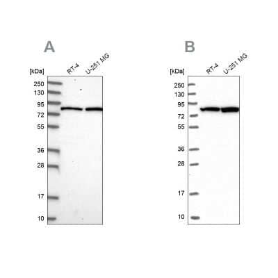 Western Blot: CSTF3 Antibody [NBP1-85428] - Analysis using Anti-CSTF3 antibody NBP1-85428 (A) shows similar pattern to independent antibody NBP1-85427 (B).