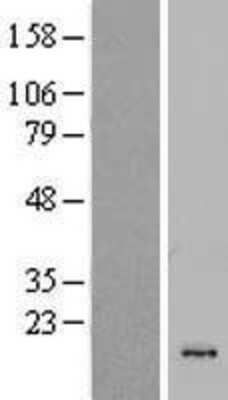 Western Blot CSTL1 Overexpression Lysate