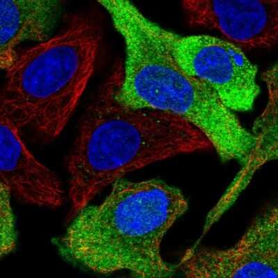 Immunocytochemistry/Immunofluorescence: CSTP1 Antibody [NBP2-58995] - Staining of human cell line A549 shows localization to cytosol.