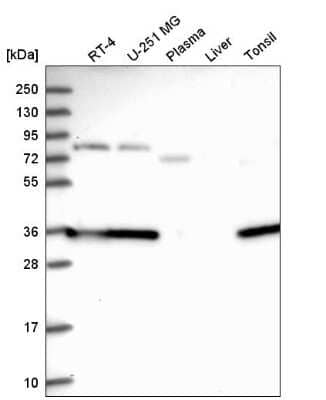 Western Blot: CSTP1 Antibody [NBP2-58995] - Western blot analysis in human cell line RT-4, human cell line U-251 MG, human plasma, human liver tissue and human tonsil tissue.