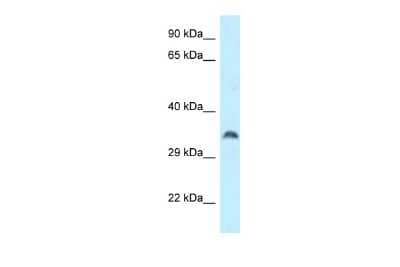 Western Blot: CSTP1 Antibody [NBP2-87222] - WB Suggested Anti-CPPED1 Antibody. Titration: 1.0 ug/ml. Positive Control: Placenta