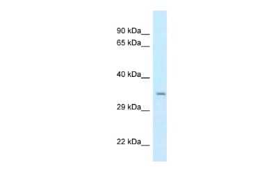 Western Blot: CSTP1 Antibody [NBP2-87223] - WB Suggested Anti-CPPED1 Antibody. Titration: 1.0 ug/ml. Positive Control: Hela Whole Cell