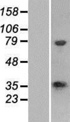 Western Blot: CSTP1 Overexpression Lysate (Adult Normal) [NBP2-06819] Left-Empty vector transfected control cell lysate (HEK293 cell lysate); Right -Over-expression Lysate for CSTP1.