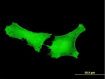 Immunocytochemistry/Immunofluorescence: CT110 Antibody [H00055105-B01P] - Analysis of purified antibody to GPATCH2 on HeLa cell. (antibody concentration 10 ug/ml)