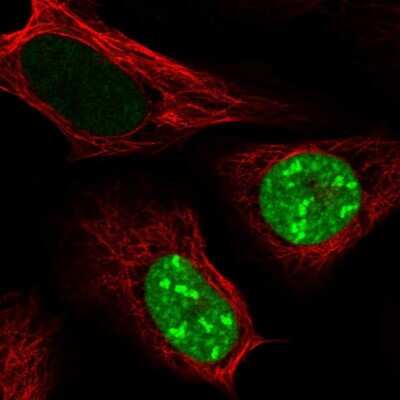 Immunocytochemistry/Immunofluorescence: CT45A1 Antibody [NBP2-46702] - Staining of human cell line U-2 OS shows localization to nucleus and nucleoli. Antibody staining is shown in green.