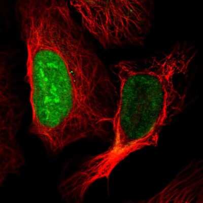 Immunocytochemistry/Immunofluorescence: CT45A1 Antibody [NBP2-46729] - Staining of human cell line U-2 OS shows localization to nucleus & nucleoli.