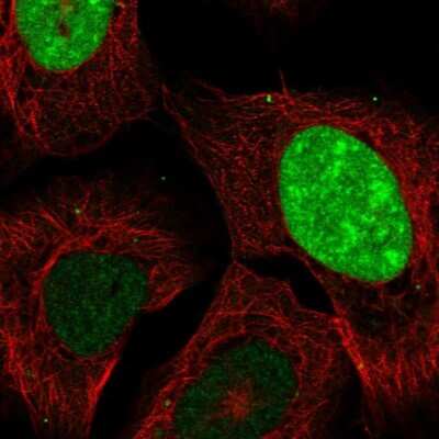 Immunocytochemistry/Immunofluorescence: CT45A1 Antibody [NBP2-46736] - Staining of human cell line U-2 OS shows localization to nucleus & nucleoli.