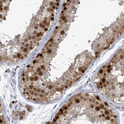 Immunohistochemistry-Paraffin: CT45A1 Antibody [NBP2-46704] - Staining of human testis shows strong nuclear positivity in cells of seminiferus ducts.