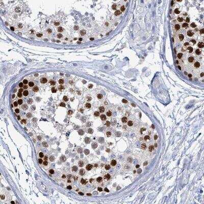 Immunohistochemistry: CT45A1 Antibody [NBP2-46729] - Staining of human testis shows strong nuclear positivity in cells in seminiferus ducts.