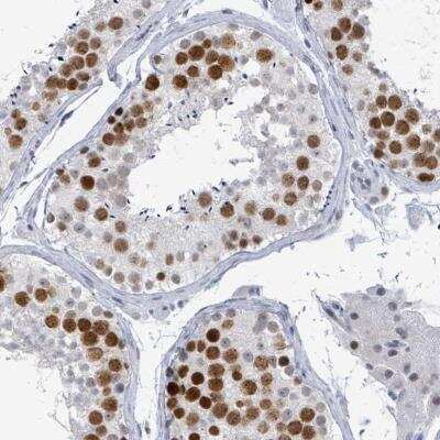 Immunohistochemistry: CT45A1 Antibody [NBP2-46736] - Staining of human testis shows strong nuclear positivity in cells in seminiferus ducts.