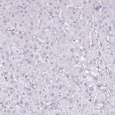 Immunohistochemistry-Paraffin CT45A1 Antibody