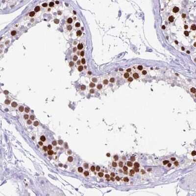 Immunohistochemistry-Paraffin CT45A1 Antibody