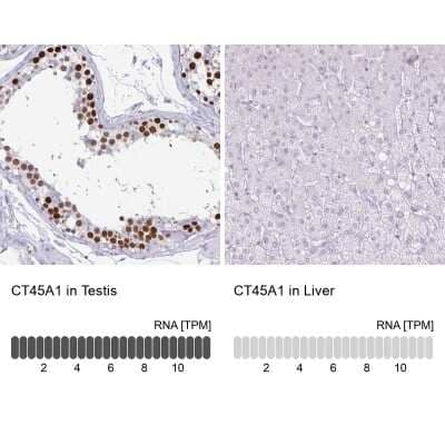 Immunohistochemistry-Paraffin CT45A1 Antibody