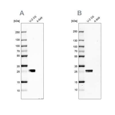 Western Blot: CT45A1 Antibody [NBP2-46702] - Analysis NBP2-46702 (A) shows similar pattern to independent antibody NBP2-46729 (B).