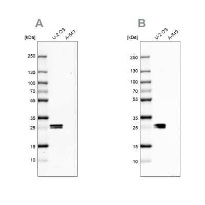 <b>Independent Antibodies Validation. </b>Western Blot: CT45A1 Antibody [NBP2-46729] - Analysis NBP2-46729 (A) shows similar pattern to independent antibody NBP2-46702 (B).