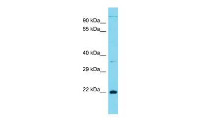 Western Blot: CT45A1 Antibody [NBP3-10719] - Western blot analysis of CT45A1 in 293T Whole Cell lysates. Antibody dilution at 1.0ug/ml