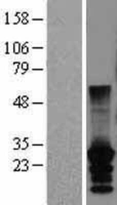 Western Blot CT45A2 Overexpression Lysate