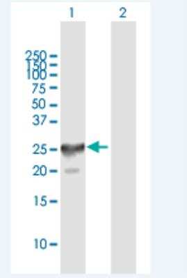 Western Blot: CT45A4 Antibody [H00441520-B01P-50ug] - Analysis of CT45-4 expression in transfected 293T cell line (H00441520-T01) by CT45-4 MaxPab polyclonal antibody. Lane 1: CT45-4 transfected lysate(20.79 KDa).Lane 2: Non-transfected lysate.