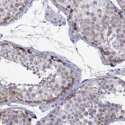 Immunohistochemistry-Paraffin: CT47A11 Antibody [NBP2-54698] - Staining of human testis shows strong cytoplasmic positivity in cells in seminiferous ducts.