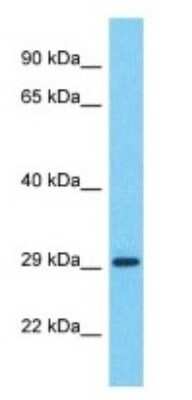 Western Blot: CT47A12 Antibody [NBP3-09916] - Western blot analysis of CT47A12 in Hela Whole Cell lysates. Antibody dilution at 1.0ug/ml