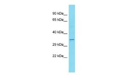 Western Blot: CT47B1 Antibody [NBP3-09701] - Western blot analysis of CT47B1 in Placenta lysates. Antibody dilution at 1.0ug/ml