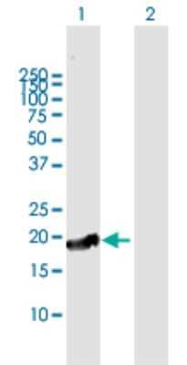 Western Blot: CTAG1A Antibody [H00246100-B01P] - Analysis of CTAG1A expression in transfected 293T cell line by CTAG1A polyclonal antibody.  Lane 1: CTAG1A transfected lysate(19.8 KDa). Lane 2: Non-transfected lysate.